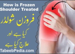 فروزن شولڈر