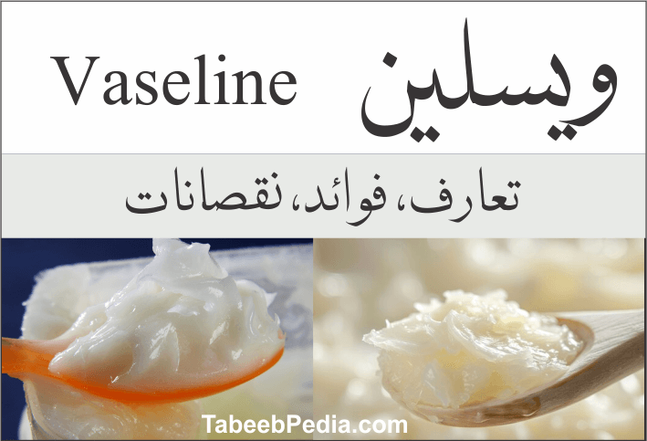 ویسلین (Vaseline)