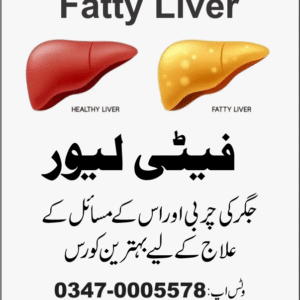 Fatty Liver