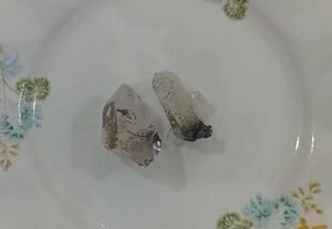 سنکھیا Arsenic संखिया