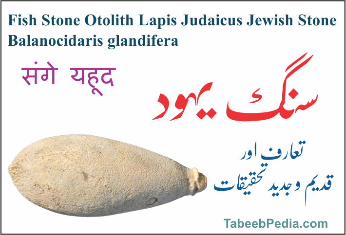 سنگ یہود